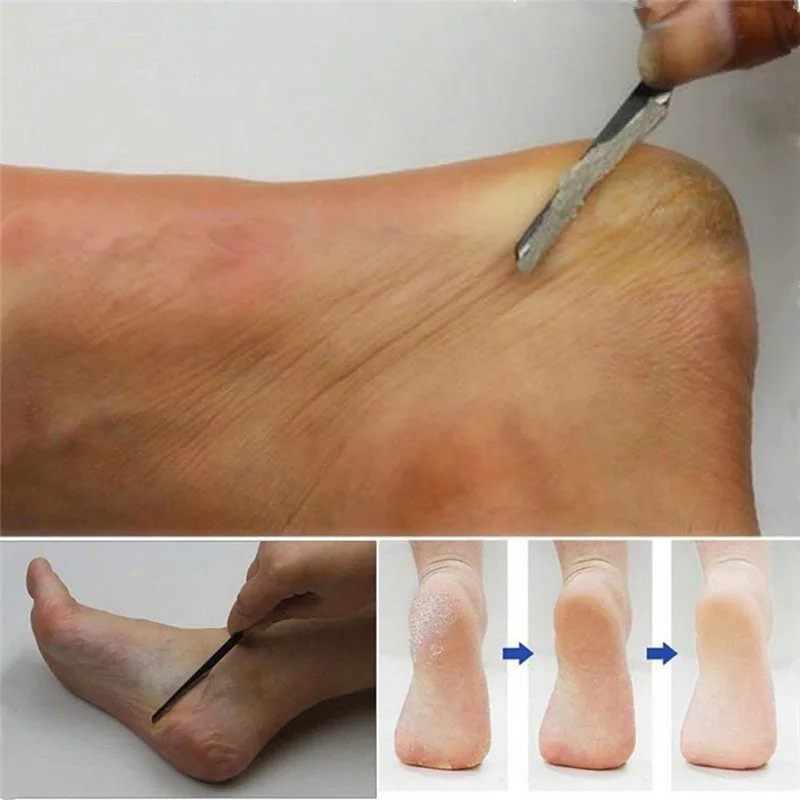

ISHOWTIENDA Pedicure Dead Skin Planer / Manicure Nail Cleaner Cuticle Grooming Nursing Foot Pedicure Foot Care Tools