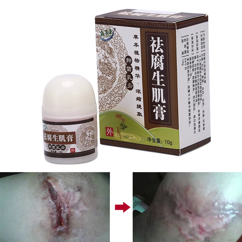 1PC Ulcer Festering Wound Healing Herbal Removal Rot Myogenic Cream ...