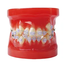 All Ceramic Bracket Orthodontic Model 28 Unit Teeth for Dentist to Communicate With Patients and Study