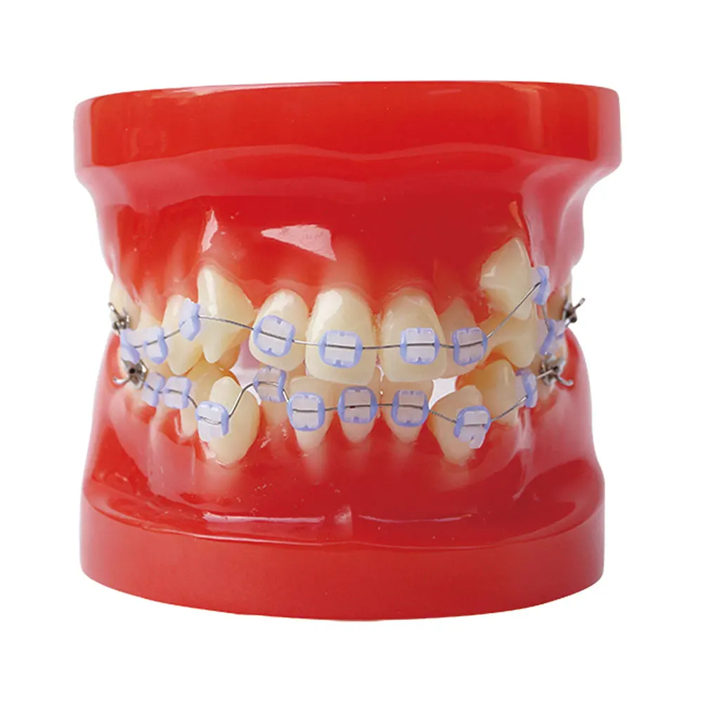 Popular Brackets OrthodonticBuy Cheap Brackets Orthodontic lots from
