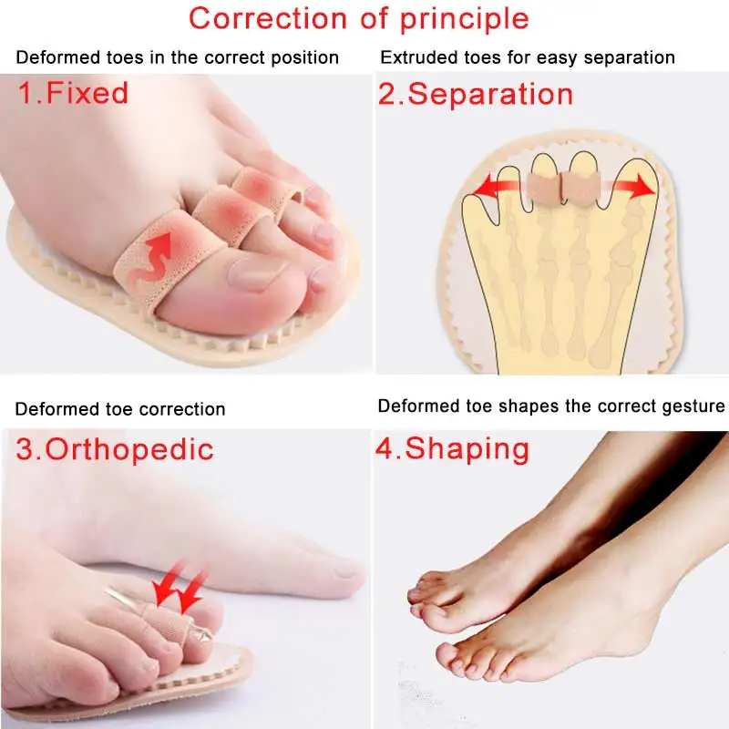 1 пара молоток разделитель пальцев ног вальгусная деформация ортопедические подушки подгибка деформация Наложение стопы коррекция носка носки