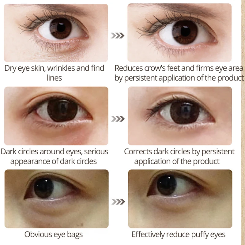 Horse Oil Eye Cream Anti-Aging Anti-Puffiness Remove wrinkles Tightens Eyes Serum Skin care Moisturizing Remove Fat Granule