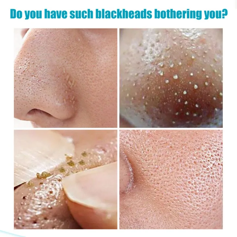 Новый Зелёный чай уход за кожей лица маска blackhead для удаления прыщей лечение нос контроль выработки кожного жира сильной фиксации воск