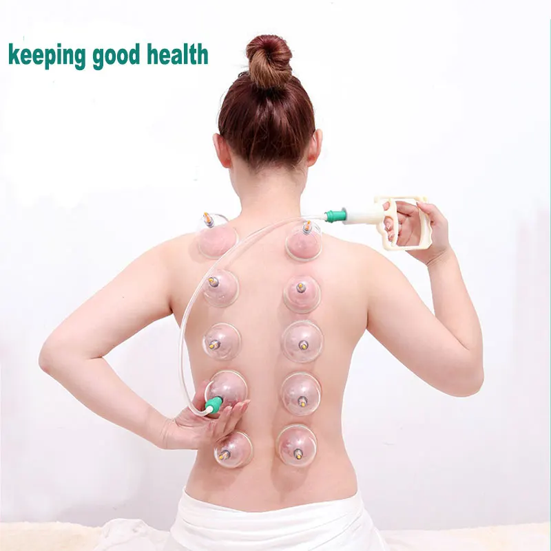 cupping (1)