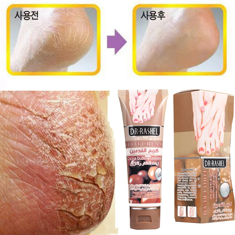 Cocoa Butter Heel Chapped Peeling Foot Hand Repair Anti Dry Crack