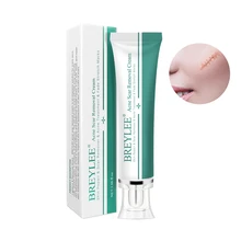 Breylee Acne Scar Removal Cream 30G Face Cream Skin Repair Skin Care Scar Acne Treatment Remove Stretch Marks Whitening Cream