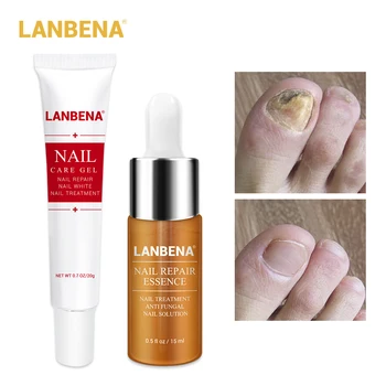 

LANBENA Nail Care Gel+Nail Repair Essence Serum Nail Treatment Remove Onychomycosis Toe Nail Nourishing Hand And Foot Care 2PCS