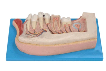 

Import 3 Times Magnification Children Tooth Model Child Teeth Anatomical Model Caries Dental Teeth Pathology Model Medical Aids