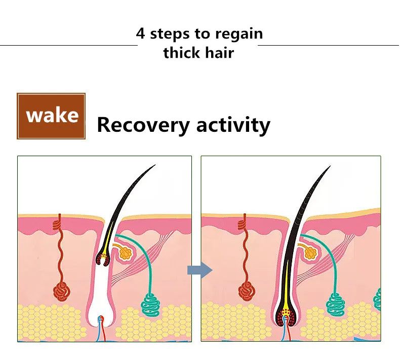 Чистый натуральный рост волос Эфирная масляная эссенция без боковых эффектов эссенция роста волос интенсивная жидкая красота уход