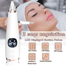 Очиститель пор для удаления черных точек вакуумный Электрический Нос для лица глубокое очищение кожи уход машина красота лица кожи инструмент подарок на день рождения