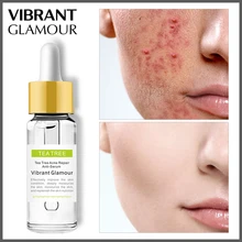 VIBRANT GLAMOUR Tea Tree Acne Eliminating Face Serum Remove Acne Scar Shrink Pores Oil Control Skin Care Whitening Moisturizing