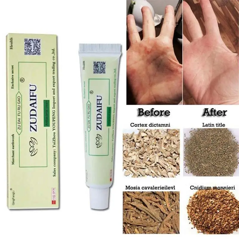 

15g/Box ZUDAIFU Psoriasis Cream Body Skin Care Problems Care Zudaifu Cream Psoriasis Tools Dropshipping