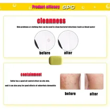 84 г серное мыло, дерматит, гриб, Eczema, антибактериальный гриб, уход за кожей, для ванны, Отбеливающее мыло OA66