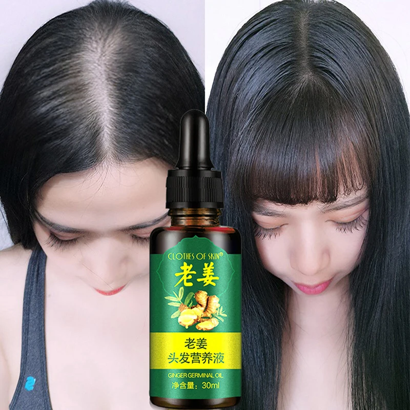 30ml Anti Hair Loss Liquid Ginger Hair Growth Serum Essence for Women and Men Damaged Hair Repair Growing Faster Repair UZ85