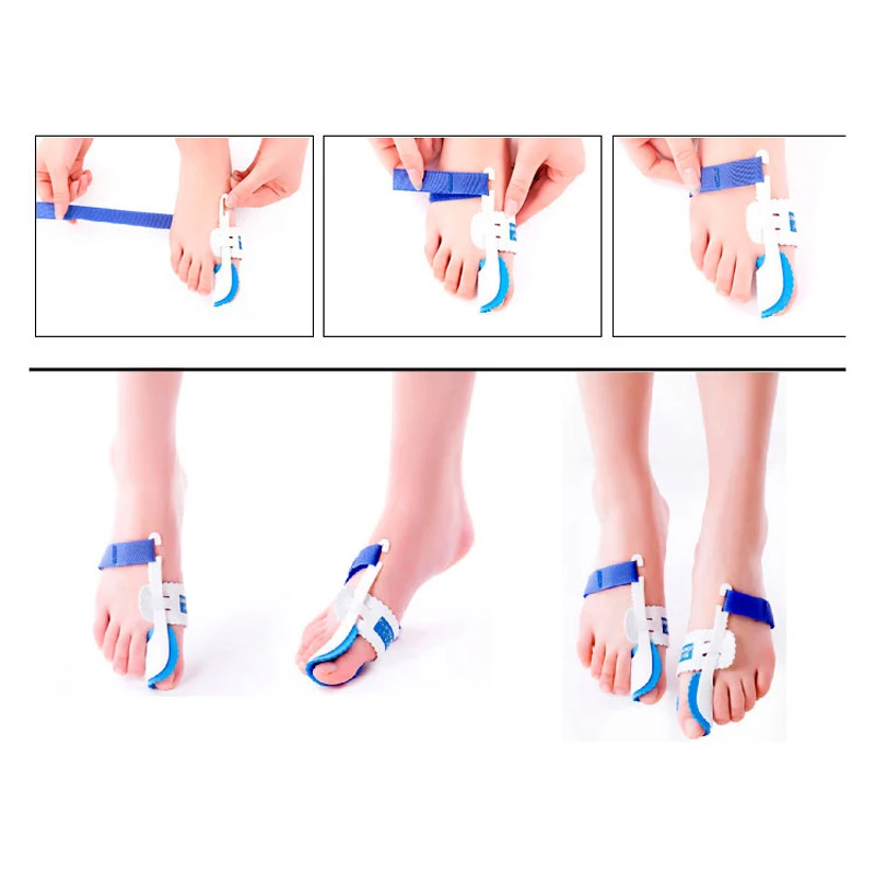 Foot Thumb Corrector Of The Toe Orthotics Bunion Corrector Splint Toe Straightener Foot Pain Relief Hallux Valgus Pedicure Tools