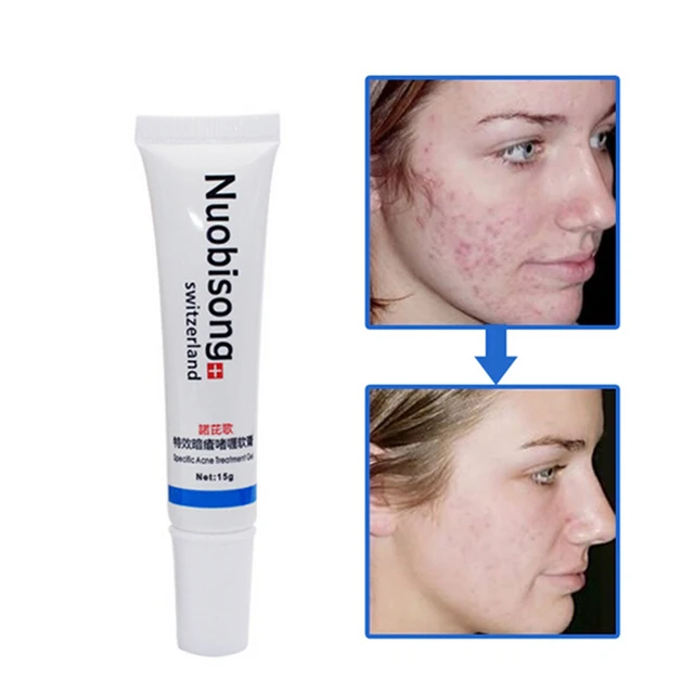 creme pour les cicatrices de boutons