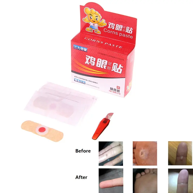 

JETTING Foot Corn Patch Detox Foot Pads Patches Feet Care Medical Plaster Foot Corn Removal Remover Callus Corn Health