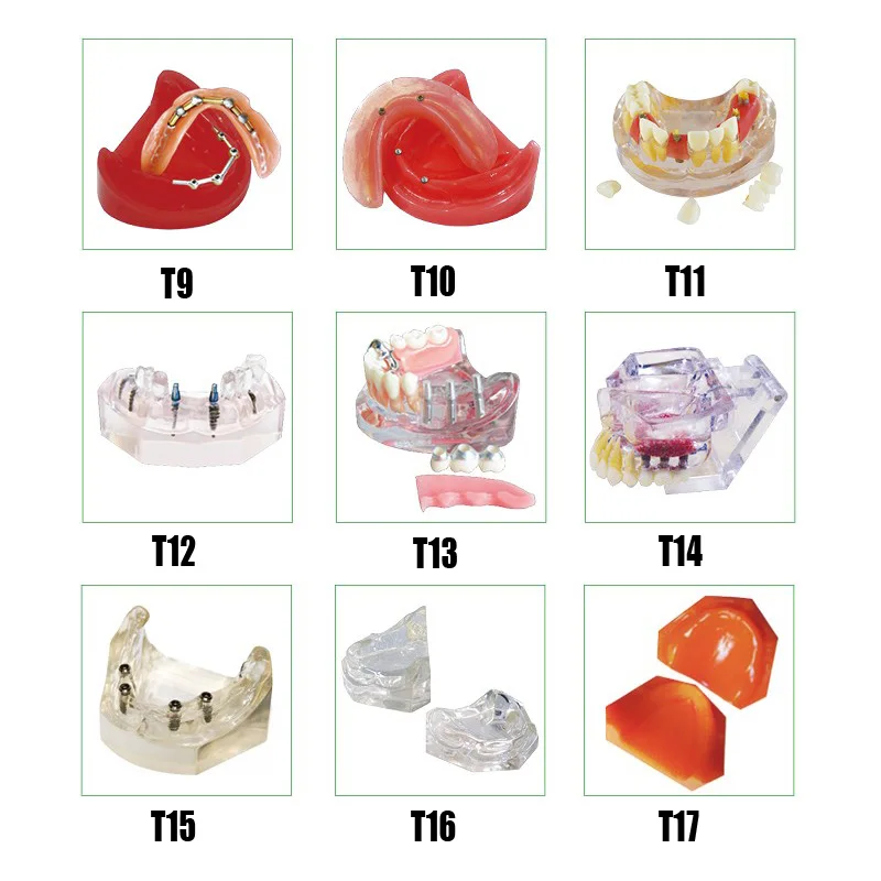Полный протез имплантата режим стоматологический edenthustal модели для тренировки имплантации модель с импортируется из смолы