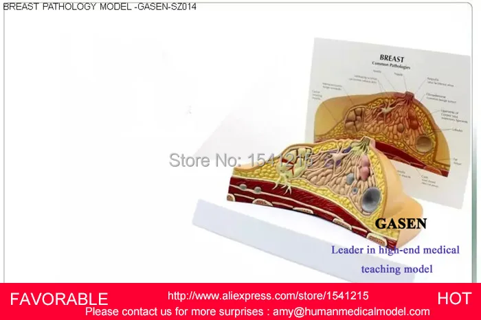 

BREAST MODEL BREAST ANATOMY ,ANATOMICAL BREAST DISEASED PATHOLOGICAL DISSECTION MEDICAL MODEL,BREAST PATHOLOGY MODEL-GASEN-SZ014