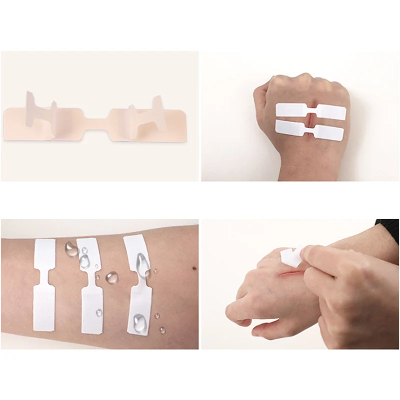 

10Pcs/Box Waterproof Adhesive Wound Closure Band Aid Emergency kit Adhesive Bandages