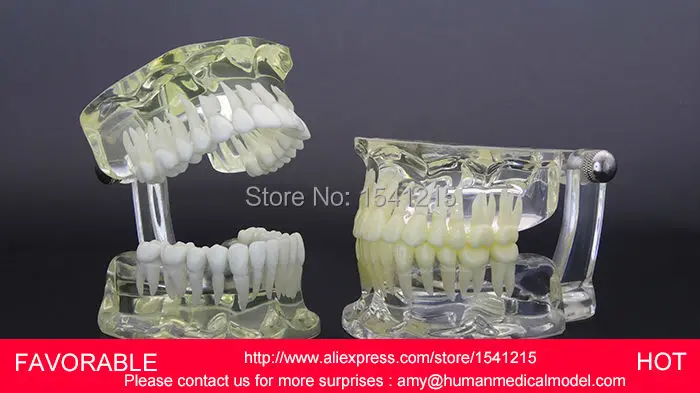 

HUMAN NATURAL SIZE DENTAL MODEL MAGNIFY DENTAL TEETH MODEL ORAL CARE ,STANDARD TRANSPARENT DENTAL MODEL DENTITION-GASEN-DEN038