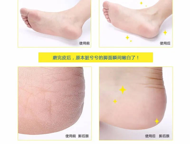 Electric Foot  (14)