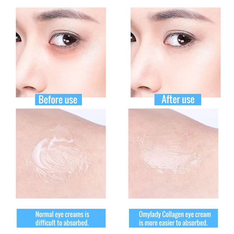 particle eye cream