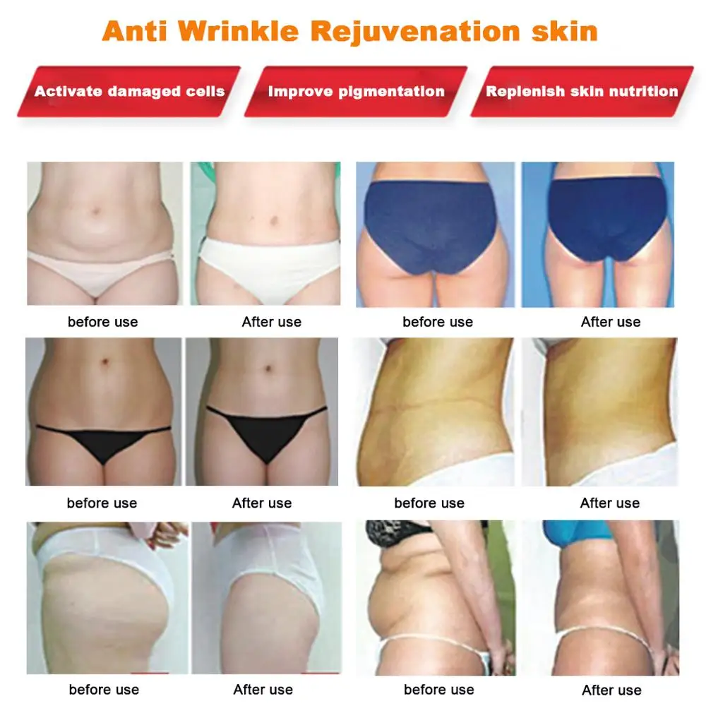  Cellulite Anti Massager Face Lift Ultrasonido Slimmer Odchudzanie Masseur Wrinkle Cavitation Machin