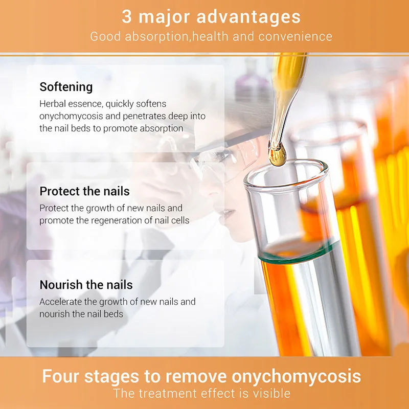 15ml Nails Care Repair Liquid Nail Fungal Treatment With File Anti Fungus Onychomycosis Removal Treatment Essence Liquid