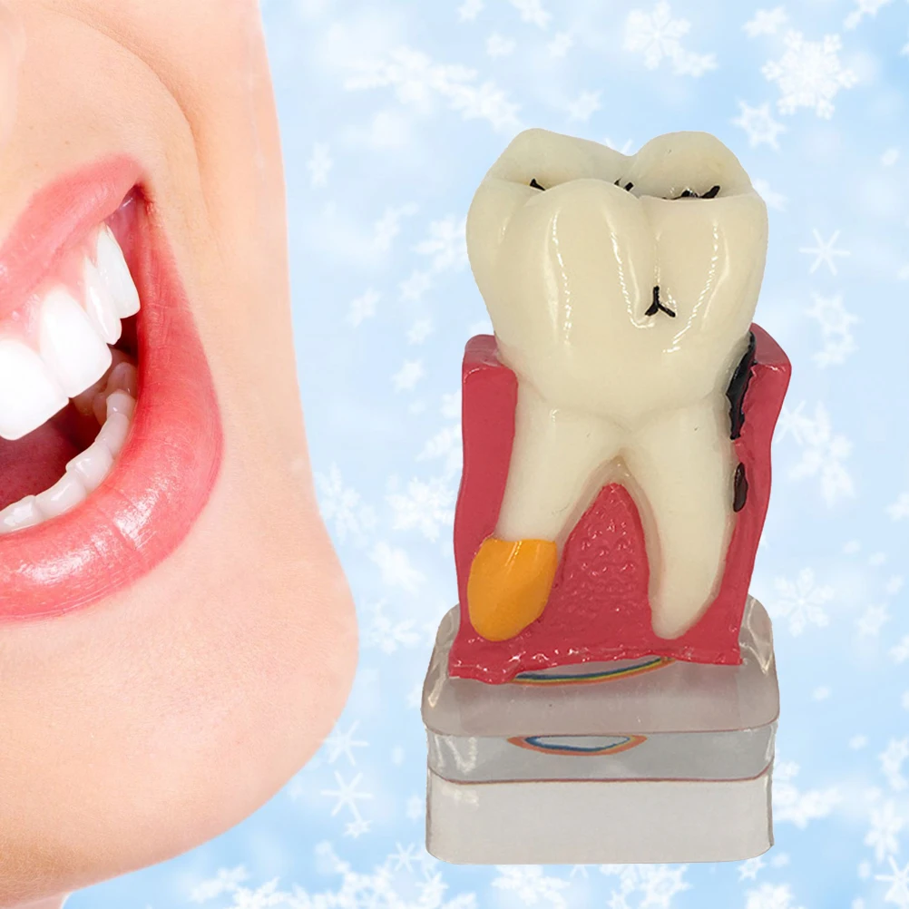 

Large Dental Adult Teeth Model 6 Times Full Mouth Tongue Model With Brush For Kindergarten Child Teaching Study Tooth Brushing