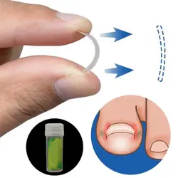 Вросшего коррекции эластичный патч ногти выпрямления клип Стикеры ногти паранихия лечения педикюр инструмент