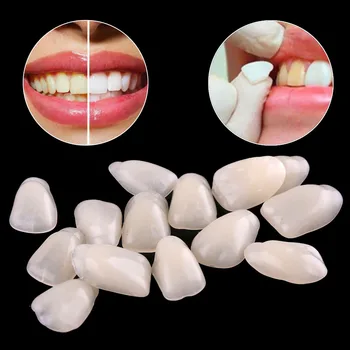 

70PCS/Bag Dental Ultra-Thin Whitening Veneers Resin Anterior Upper Temporary Crown Porcelain Dental Material Oral Healthy Care