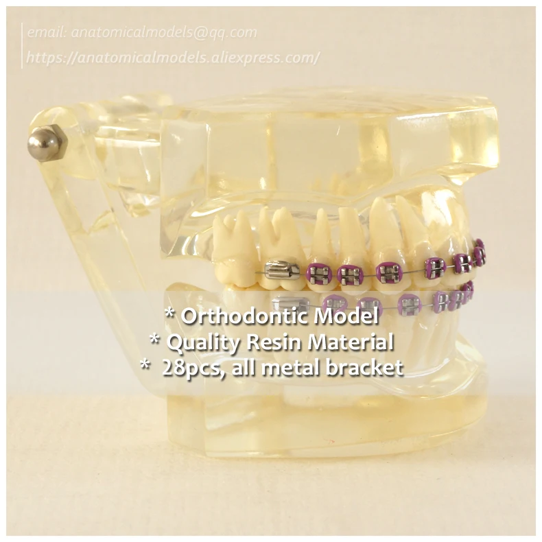 

No.13043, Clear Orthodontic Model, Dentist Transparent Oral Dental Ortho Metal Model, China Medical Anatomical Model