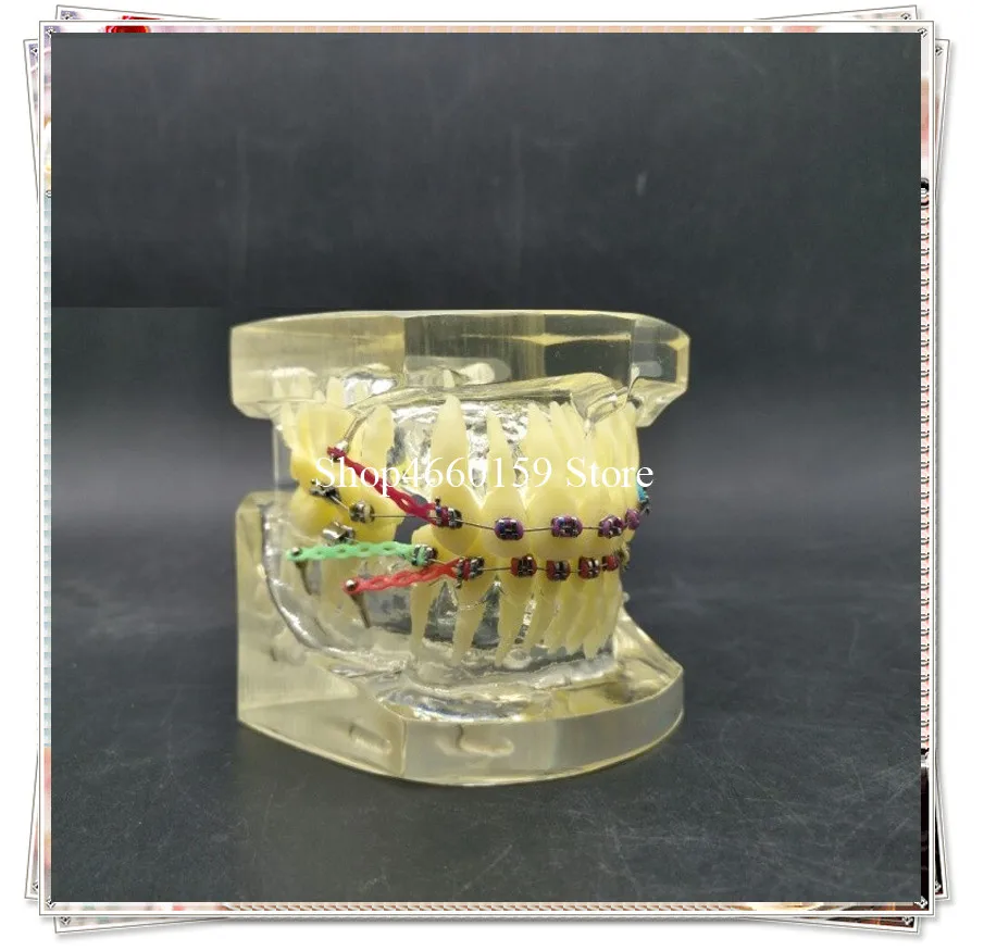 

Dental Orthodontic Model M3005 shows extraction of the crowded teeth/Dental Education teeth model show bracket& micro implant