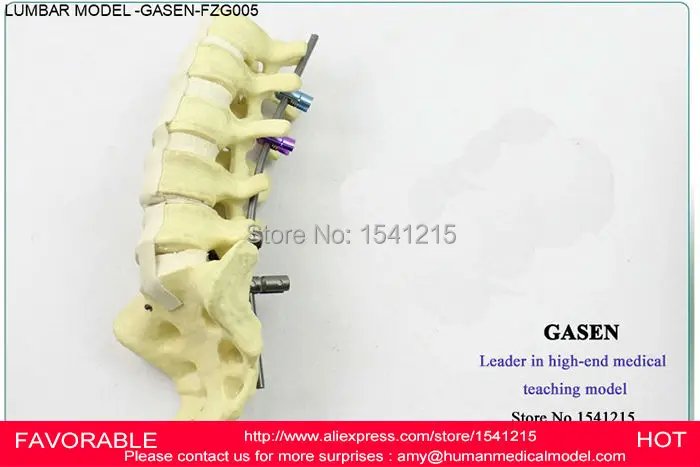 LUMBAR SPINE INCLUDE THIGH-BONE MODEL, LUMBAR SPINE SPINE MODEL OF THE HUMAN MINOR PELVIS,HUMAN LUMBAR SPINE MODEL -GASEN-FZG005