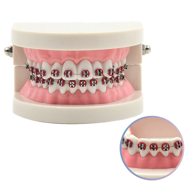 

Dental Adult Typodont Demonstration with Brackets Teeth Tooth Model Teach Study Model