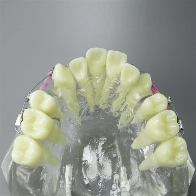 1 шт. прозрачный Зуб модель зубы Malocclusion Ортодонтическая красочная модель Стоматологическое исследование стоматолога обучение