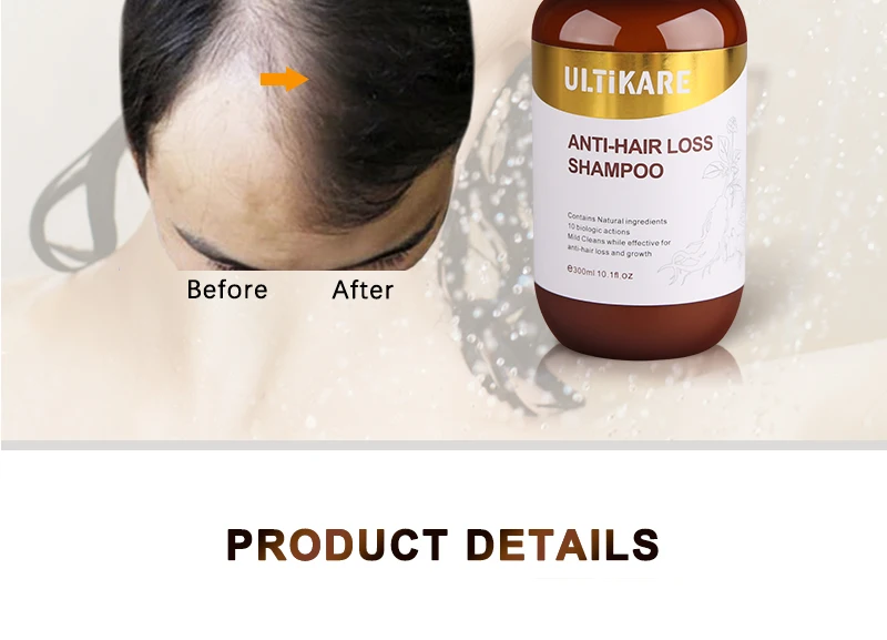 防脱生发详情页_08