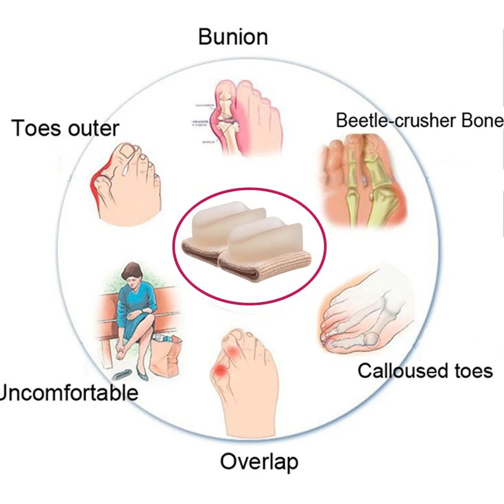 1 шт. Bunion носок разделитель для Ноги Уход Инструмент гель при деформации стопы коррекционные сепараторы вальгусный сепаратор для пальцев