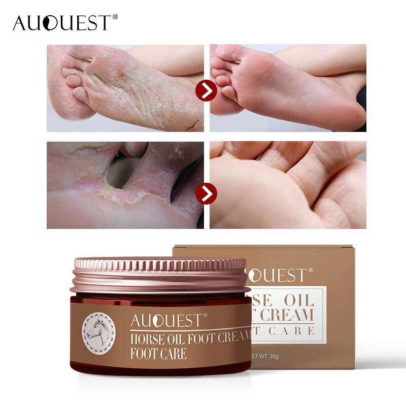 

AuQuest Foot Cream Antifungal Itch Anti-chapping Blisters Foot Peeling Skin Deep-repair Moisturizing Soft Smooth Foot Care