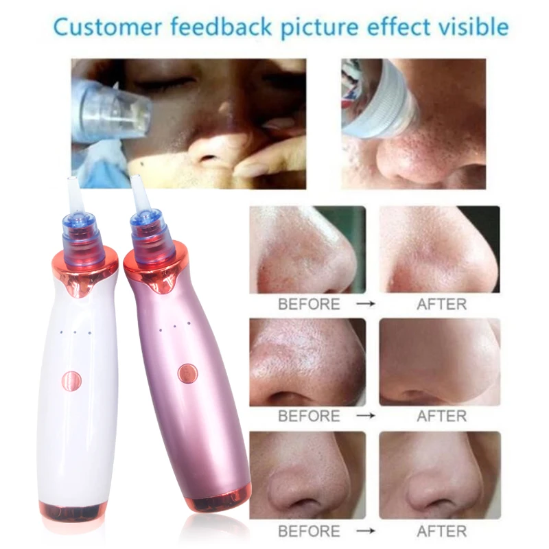 

Electric Acne Blackhead Remover Vacuum Extractor Tool Pimple Removal Skin Pore Vacuum Suction Tool Pore Cleaner Skin Care Tool
