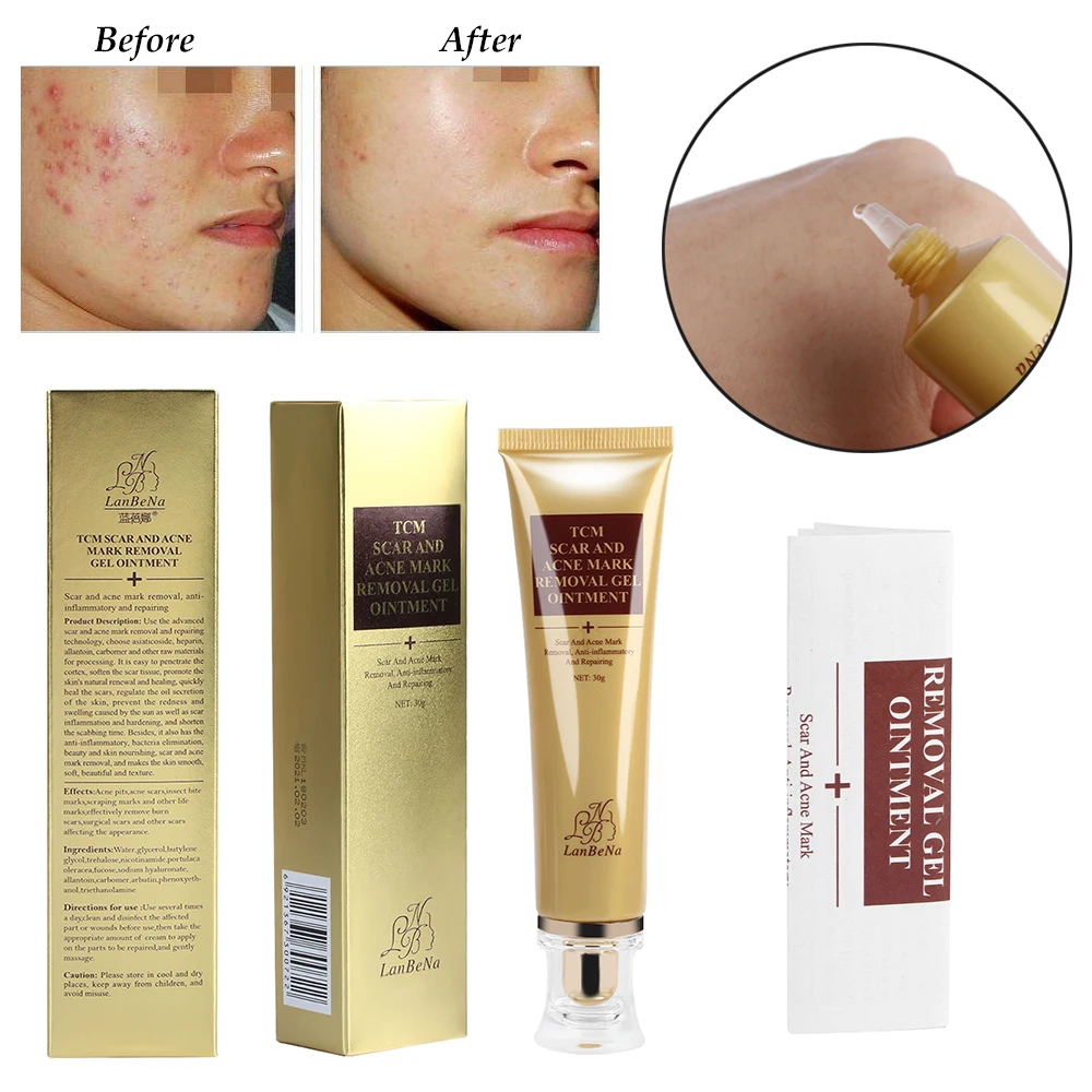 30ml Ginseng Extract Against Black Dots Cream Scar Removal Facial Blackhead Acne Body Skin