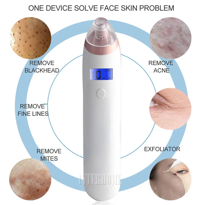 Blackhead-Remover-0899-2(8)