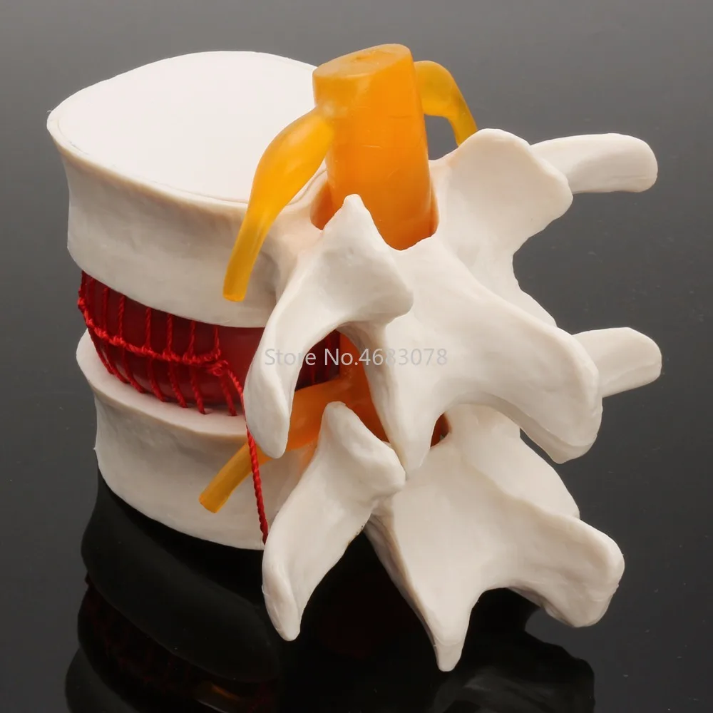 Beste Dental 11 Menselijk anatomie skelet Wervelkolom Lumbale Hernia Onderwijs Model