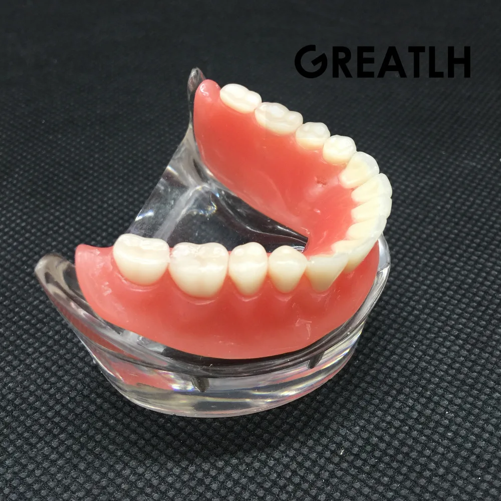 Зубные Overdenture Зубы Модель съемный интерьер нижние челюсти модель нижние челюсти с имплантатом для зуб обучения, изучения