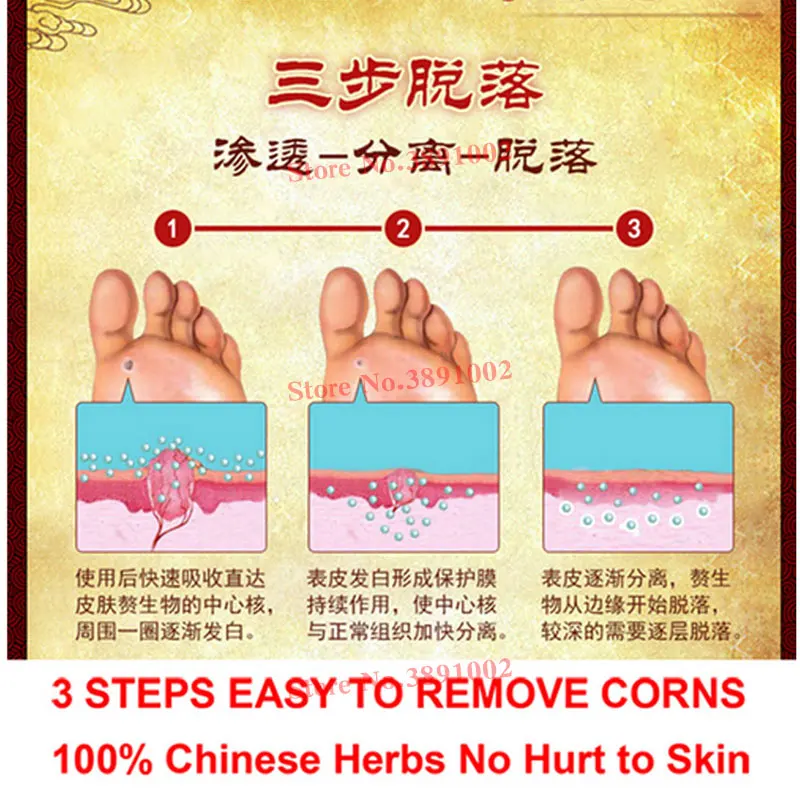 Лечение китайской медициной крем для удаления кукурузы для ног лечение плантарных бородавок лечение ног медицинский пластырь мазь удаление бородавок жидкость