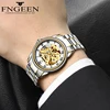Lover's Watches