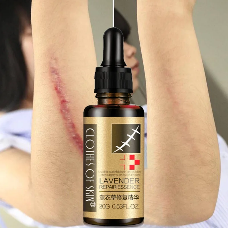

30g Scar Repair Skin Essential Oil Lavender Essence Skin Care Natural Pure Remove Ance Burn Strentch Marks Scar Removal 2019