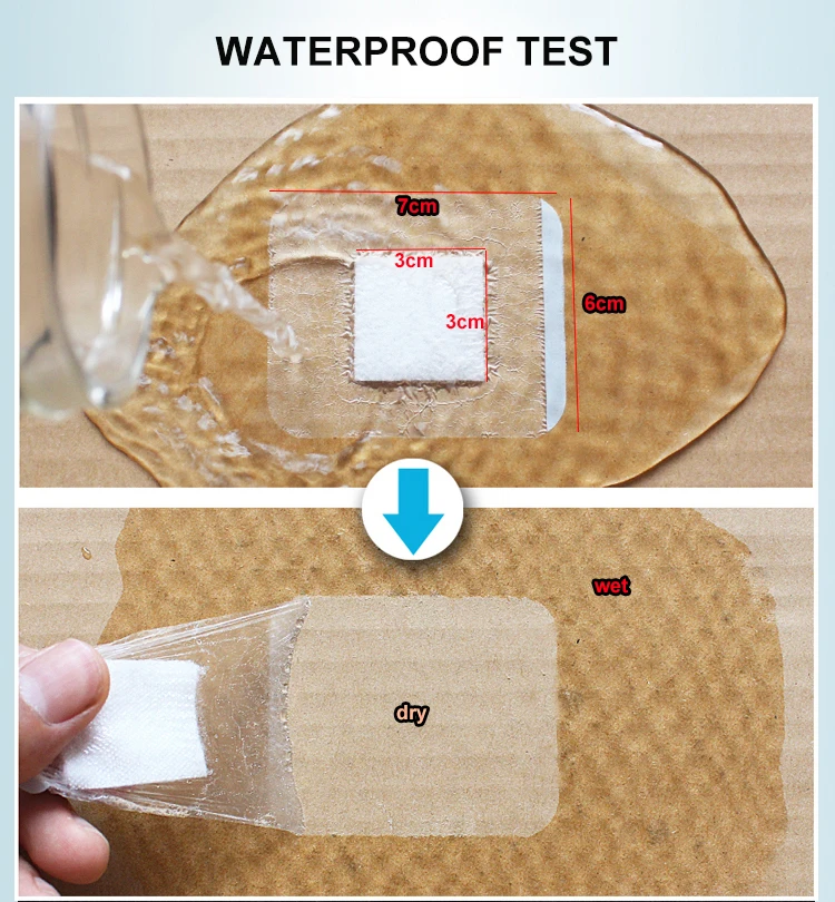 30 pcslot Waterproof Wound Dressing Band-Aid Medical Transparent Sterile Tape Breathable Navel Paste Bath Band-aids Bandages (5)