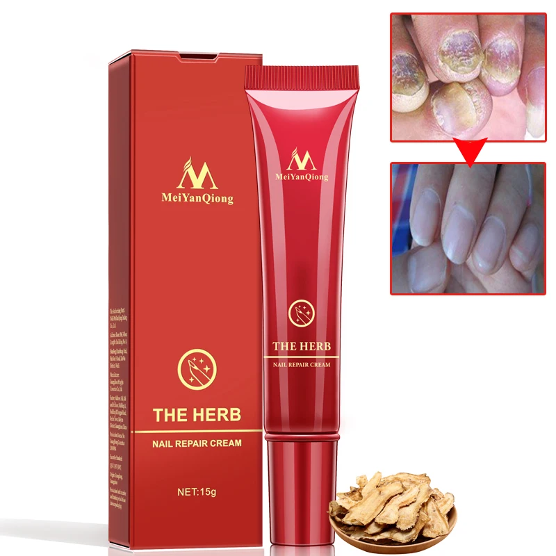 

High Quality Nail Foot Protector Skin Care Cream Nail Fungus Treatment Herb Nails Repair Cream Nail Care Tools